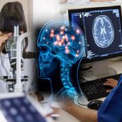 5 Common Medical Problems Associated with Alzheimer’s Disease