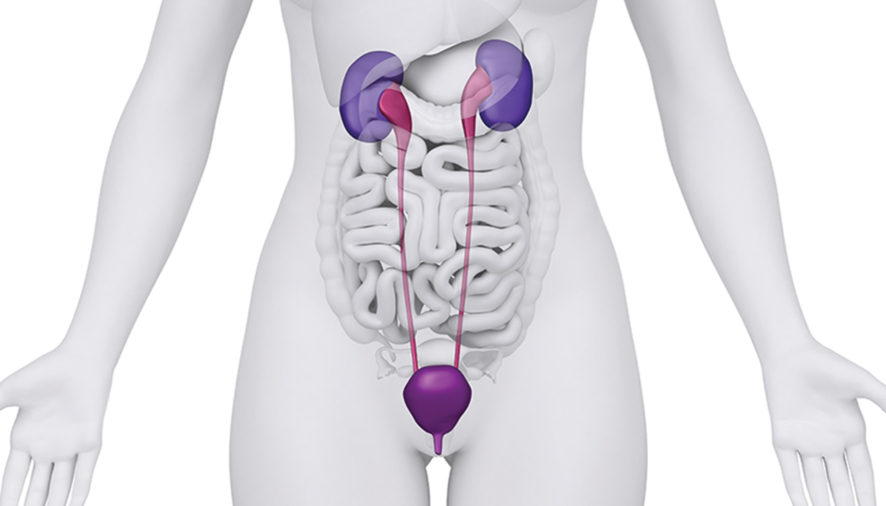 How to Treat Urinary Incontinence